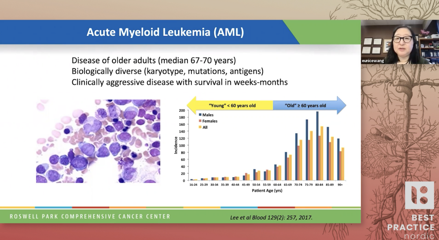 Treatment Options For Flt3 Mutant Acute Myeloid Leukemia Treatment Options For Flt3 Mutant Acute Myeloid Leukemia
